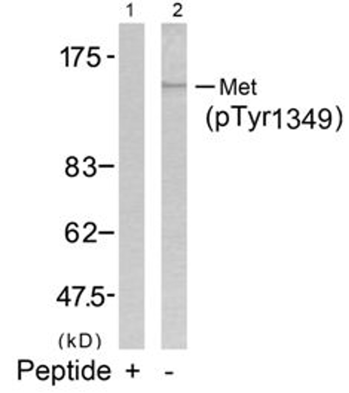 Western blot analysis of lysed extracts from HepG2 cells using Met (Phospho-Tyr1349) .