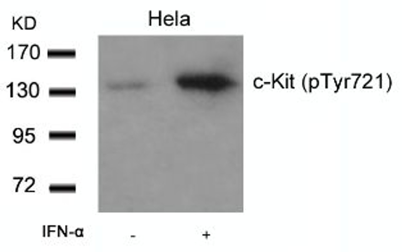 Western blot analysis of lysed extracts from HeLa cells untreated or treated with IFN-&#945; using c-Kit (Phospho-Tyr721) .