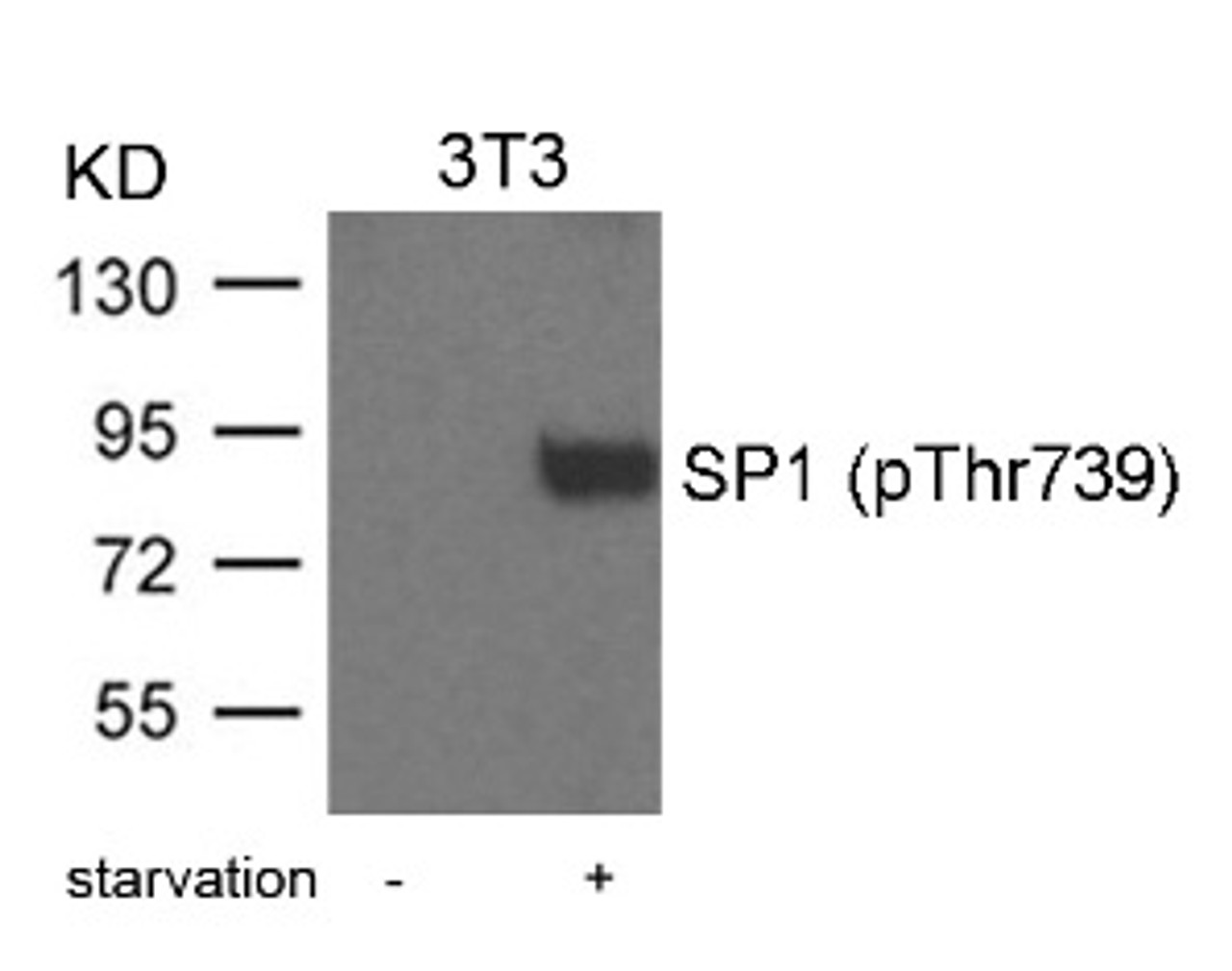 Western blot analysis of lysed extracts from 3T3 cells treated with starvation using SP1 (Phospho-Thr739) .