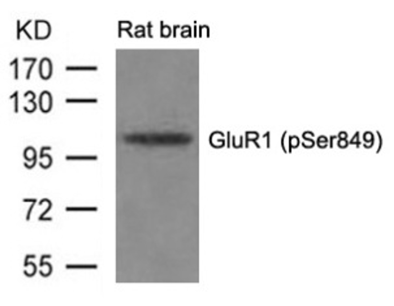 Western blot analysis of lysed extracts from Rat brain tissue using GluR1 (phospho-Ser849) .