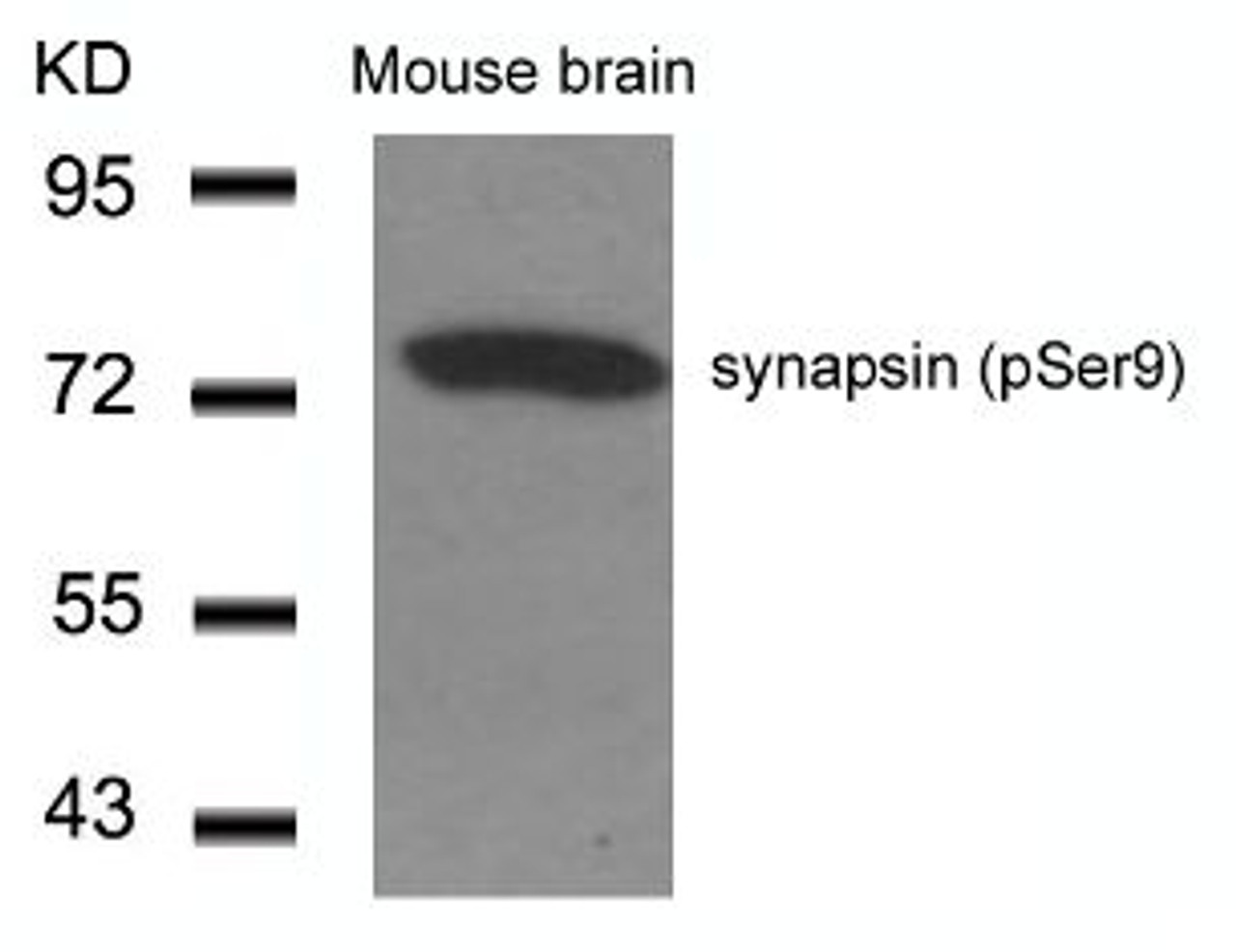 Western blot analysis of lysed extracts from Mouse Brain tissue using synapsin (Phospho-Ser9) .