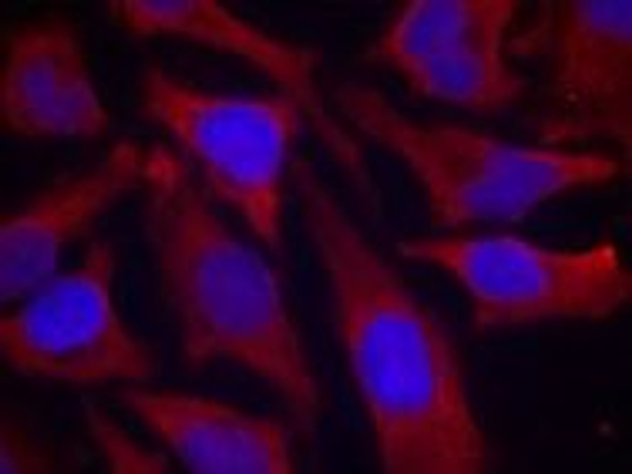 Immunofluorescence staining of methanol-fixed HeLa cells using synapsin (Phospho-Ser9) .