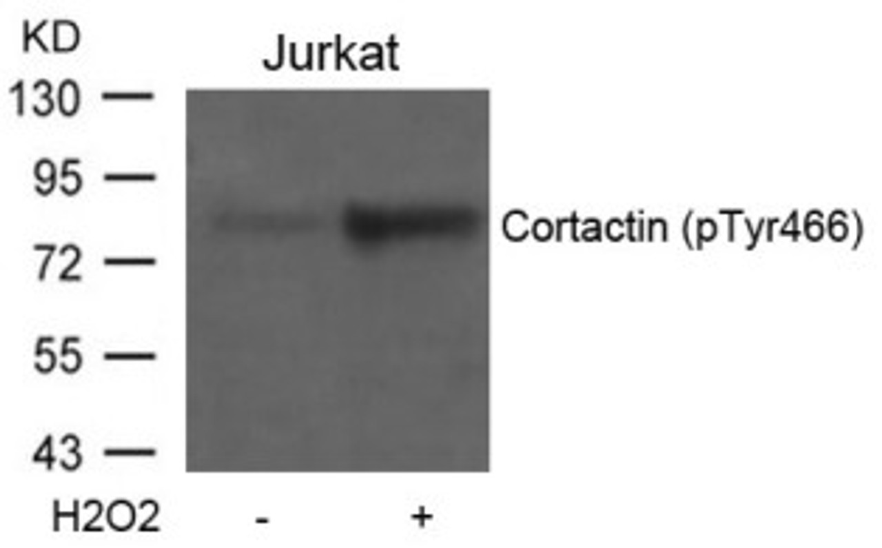 Western blot analysis of lysed extracts from Jurkat cells untreated or treated with H2O2 using Cortactin (Phospho-Tyr466) .