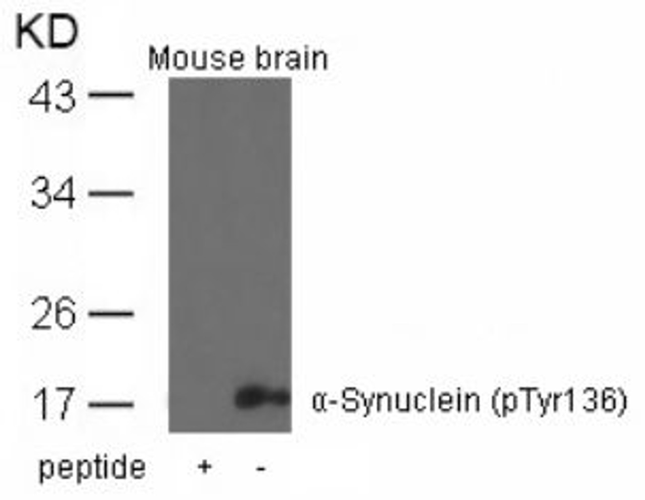 Western blot analysis of lysed extracts from mouse brain tissue using &#945;-Synuclein (Phospho-Tyr136) .