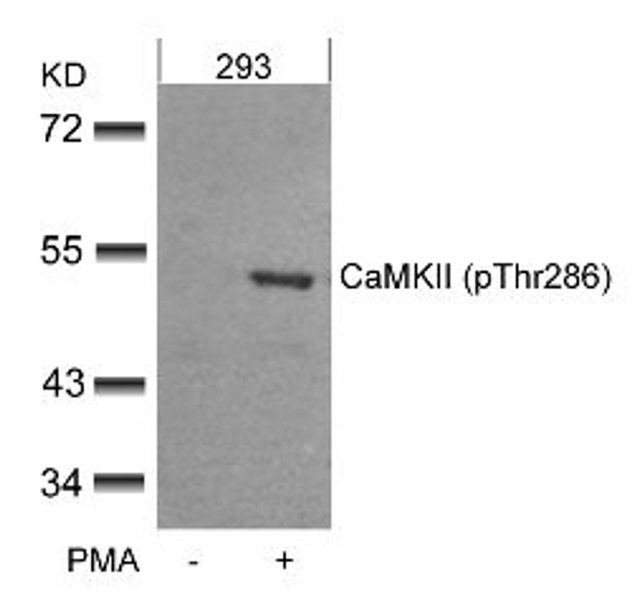 Western blot analysis of lysed extracts from 293 cells untreated or treated with PMA using CaMKII (Phospho-Thr286) .