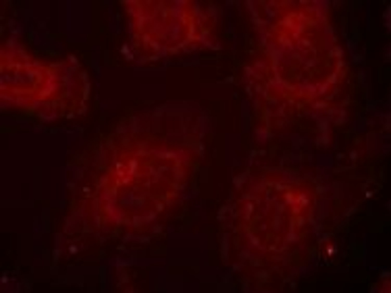Immunofluorescence staining of methanol-fixed HeLa cells using Gab1 (Phospho-Tyr627) .