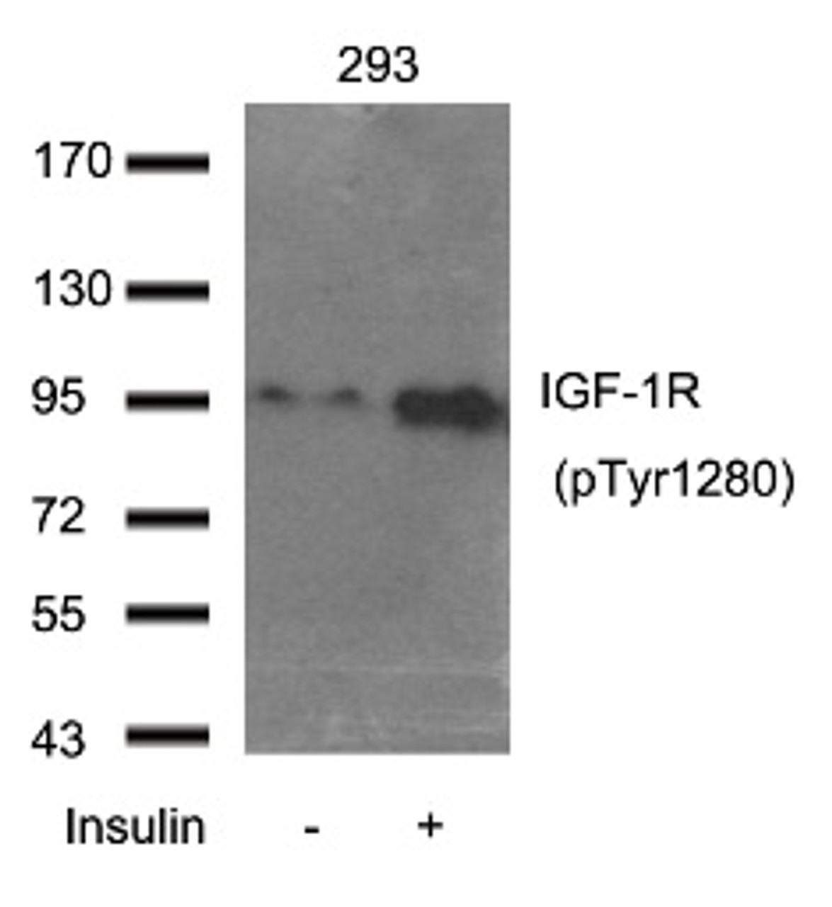 Western blot analysis of extract from 293 cells using IGF-1R (Phospho-Tyr1280) .