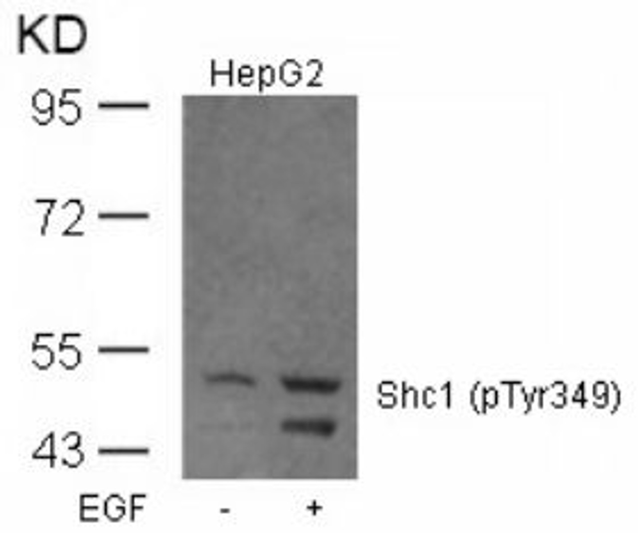 Western blot analysis of lysed extracts from HepG2 cells untreated or treated with EGF using Shc1 (Phospho-Tyr349) .
