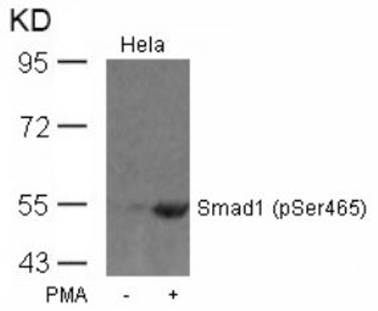 Western blot analysis of lysed extracts from HeLa cells untreated or treated with PMA using Smad1 (Phospho-Ser465) .