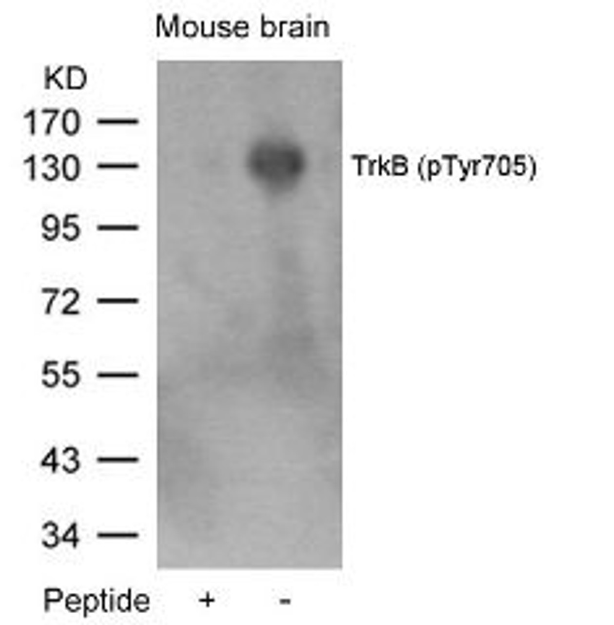 Western blot analysis of lysed extracts from mouse brain tissue using TrkB (Phospho-Tyr705) .