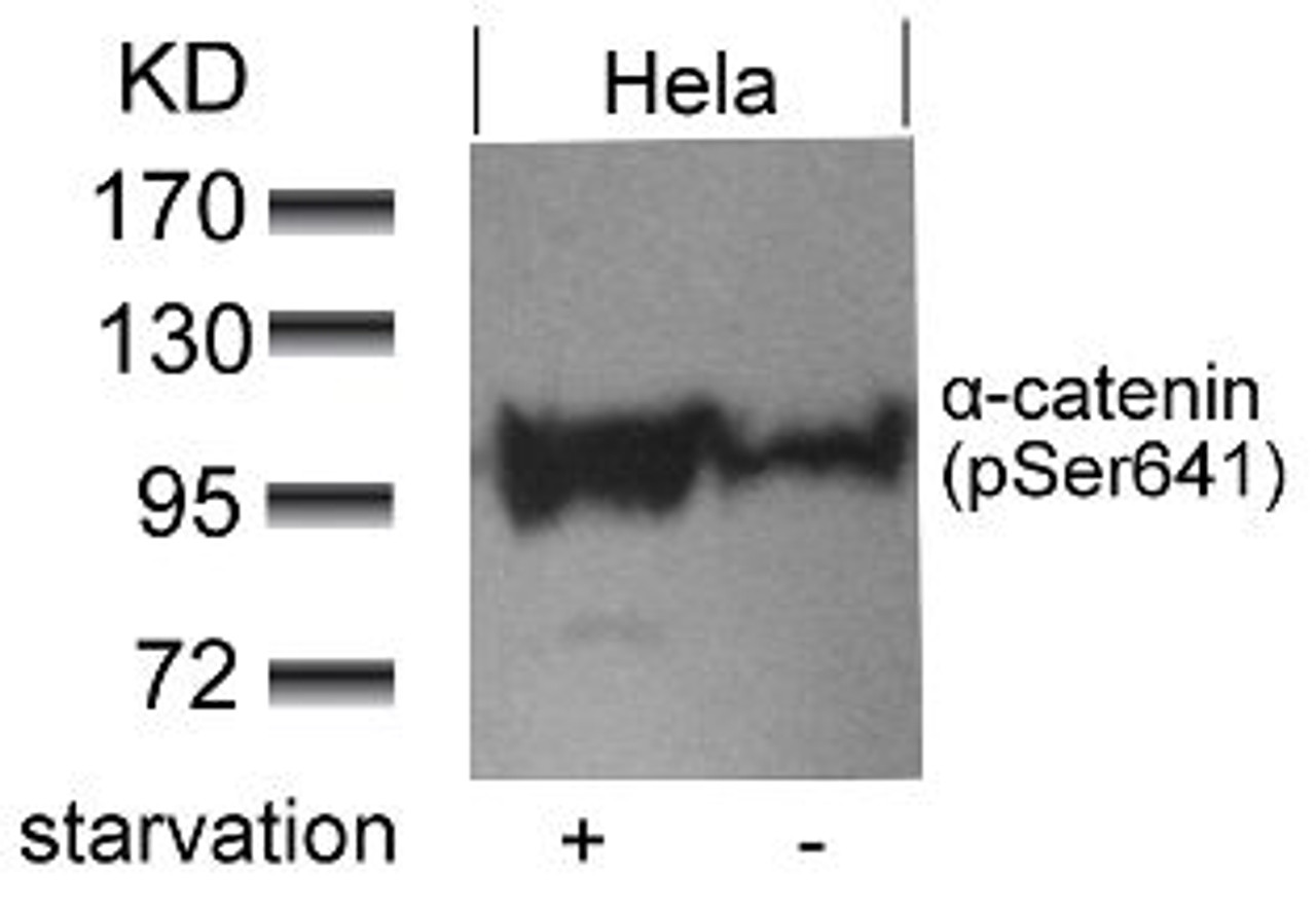 Western blot analysis of lysed extracts from HeLa cells untreated or treated with starvation using &#945;-catenin (Phospho-Ser641) .