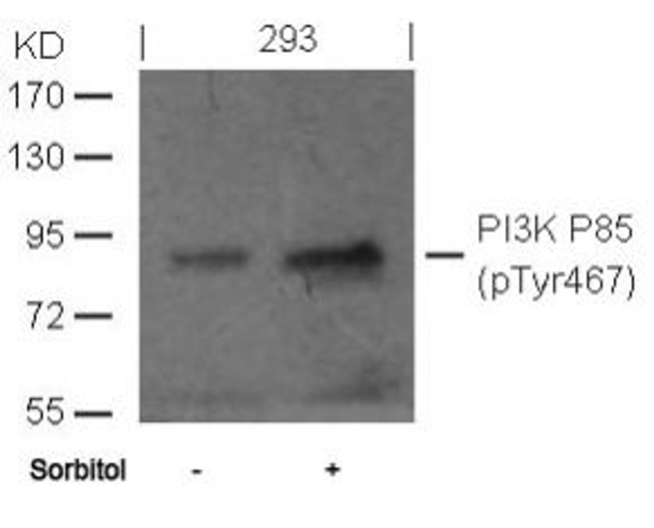 Western blot analysis of lysed extracts from 293 cells untreated or treated with sorbitol using PI3K P85 (phospho-Tyr467) .