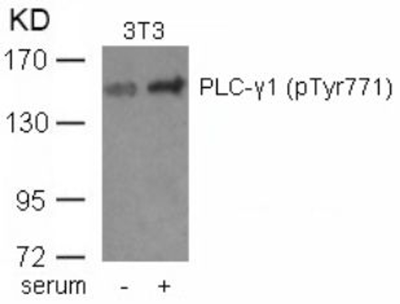 Western blot analysis of lysed extracts from 3T3 cells untreated or treated with serum using PLC-&#947;1 (phospho-Tyr771) .