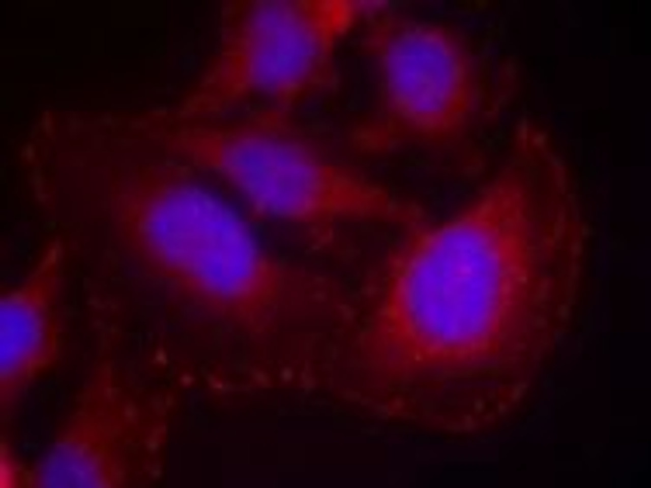 Immunofluorescence staining of methanol-fixed HeLa cells using PLC-&#947;1 (phospho-Tyr771) .