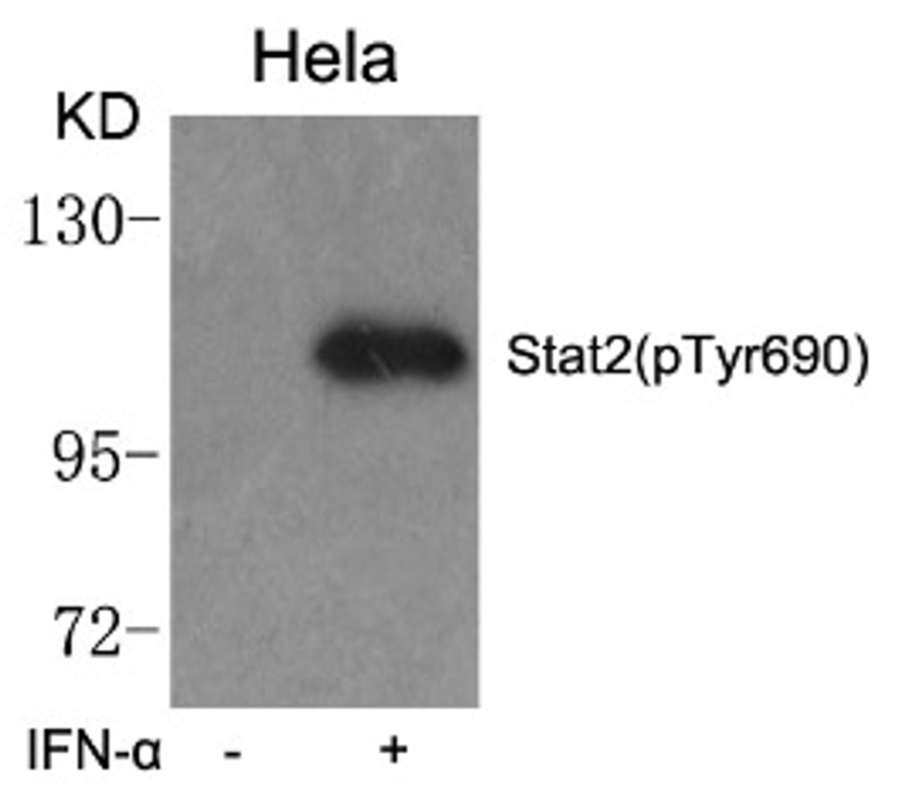 Western blot analysis of lysed extracts from HeLa cells untreated or treated with IFN-&#945; using Stat2 (phospho-Tyr690) .