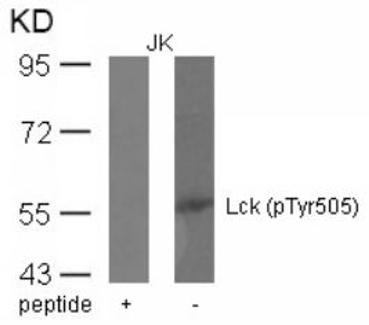 Western blot analysis of lysed extracts from JK cells using Lck (phospho-Tyr505) .