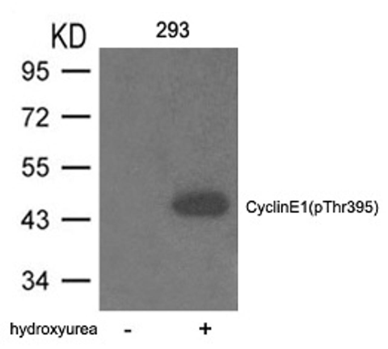 Western blot analysis of lysed extracts from 293 cells untreated or treated with hydroxyurea using Cyclin E1 (phospho-Thr395) .