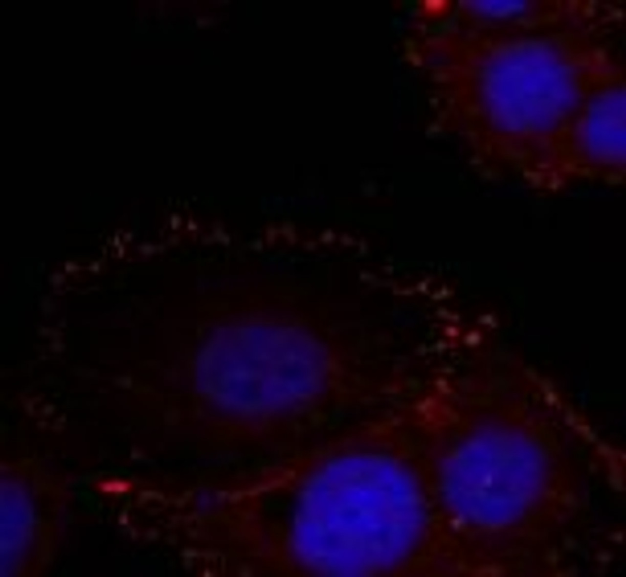 Immunofluorescence staining of methanol-fixed HeLa cells using FAK (phospho-Tyr576/Tyr577) .