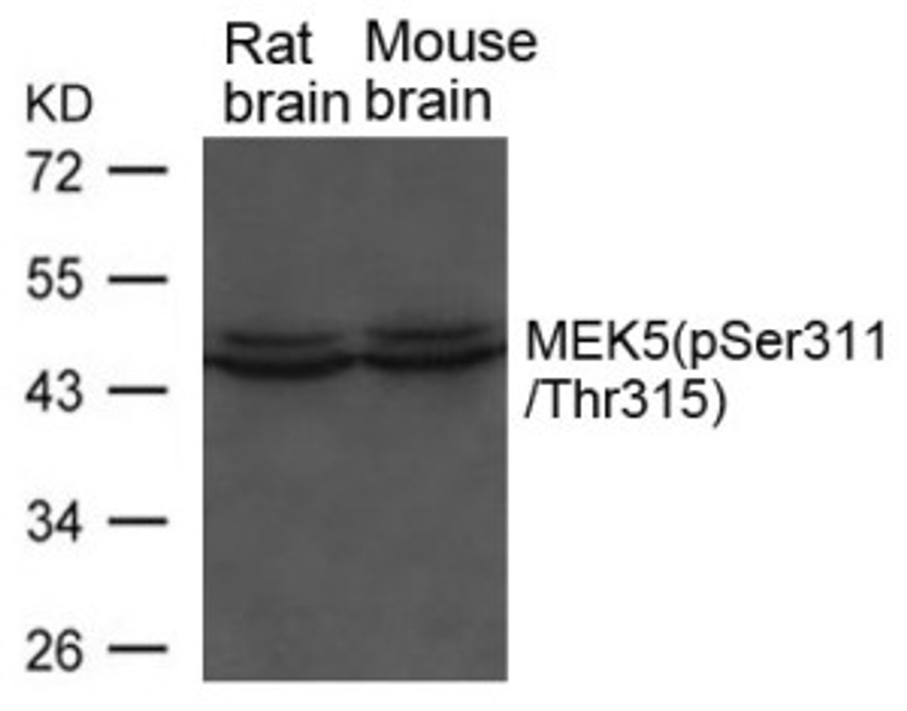 Western blot analysis of lysed extracts from Rat and Mouse brain tissue using MEK5 (phospho-Ser311/ Thr315) .