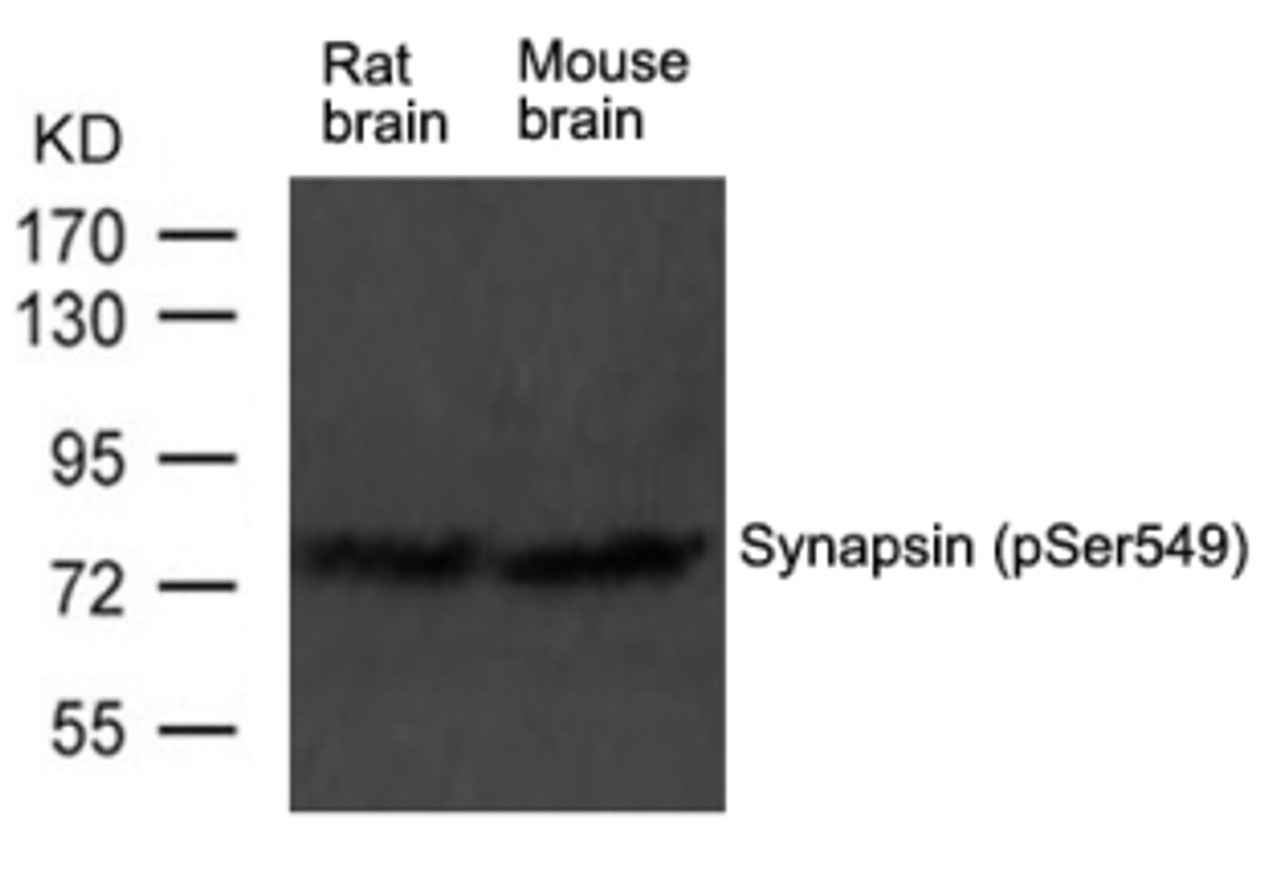 Western blot analysis of extract from rat brain and mouse brain tissue using Synapsin (phospho-Ser549) Antibody.