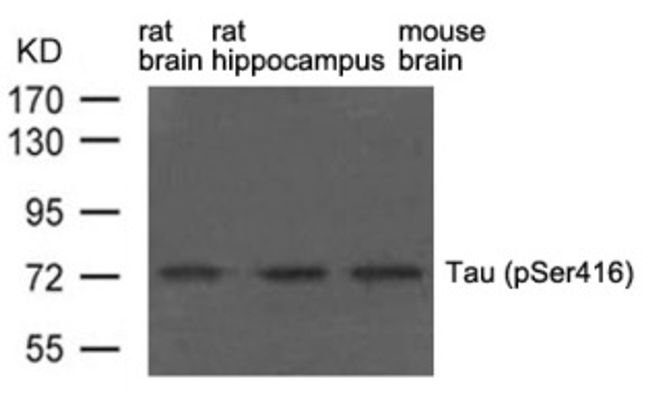 Western blot analysis of extract from rat brain, rat hippocampus and mouse brain using Tau (phospho-Ser416) .