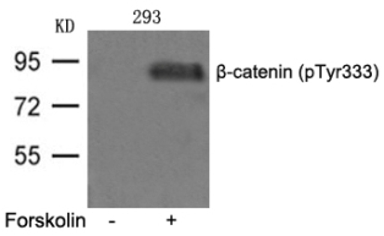 Western blot analysis of lysed extracts from 293 cells untreated or treated with FSK using &#946;-catenin (phospho-Tyr333) .