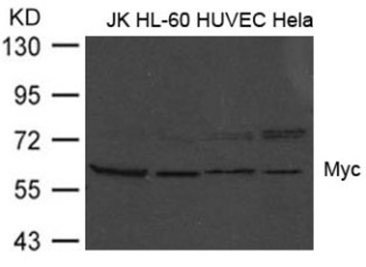 Western blot analysis of extract from JK, HL-60, HUVEC and HeLa cells using Myc (Ab-373) .