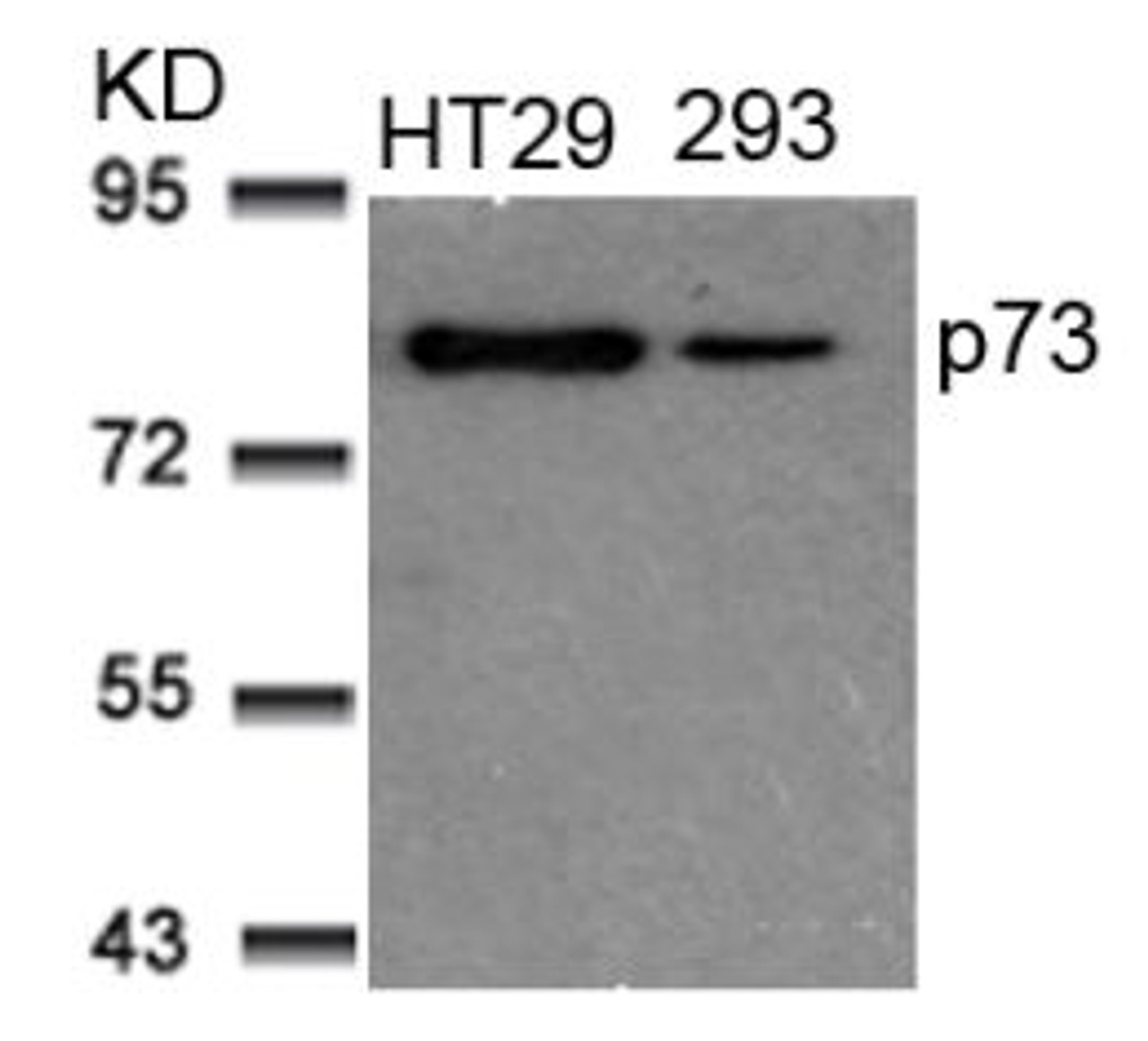Western blot analysis of lysed extracts from HT29 and 293 cells using p73 (Ab-99) .