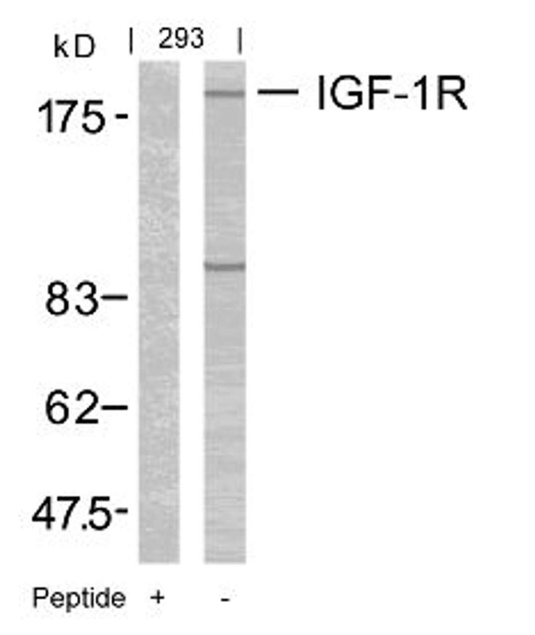 Western blot analysis of lysed extracts from 293 cells using IGF-1R (Ab-1165/1166) .