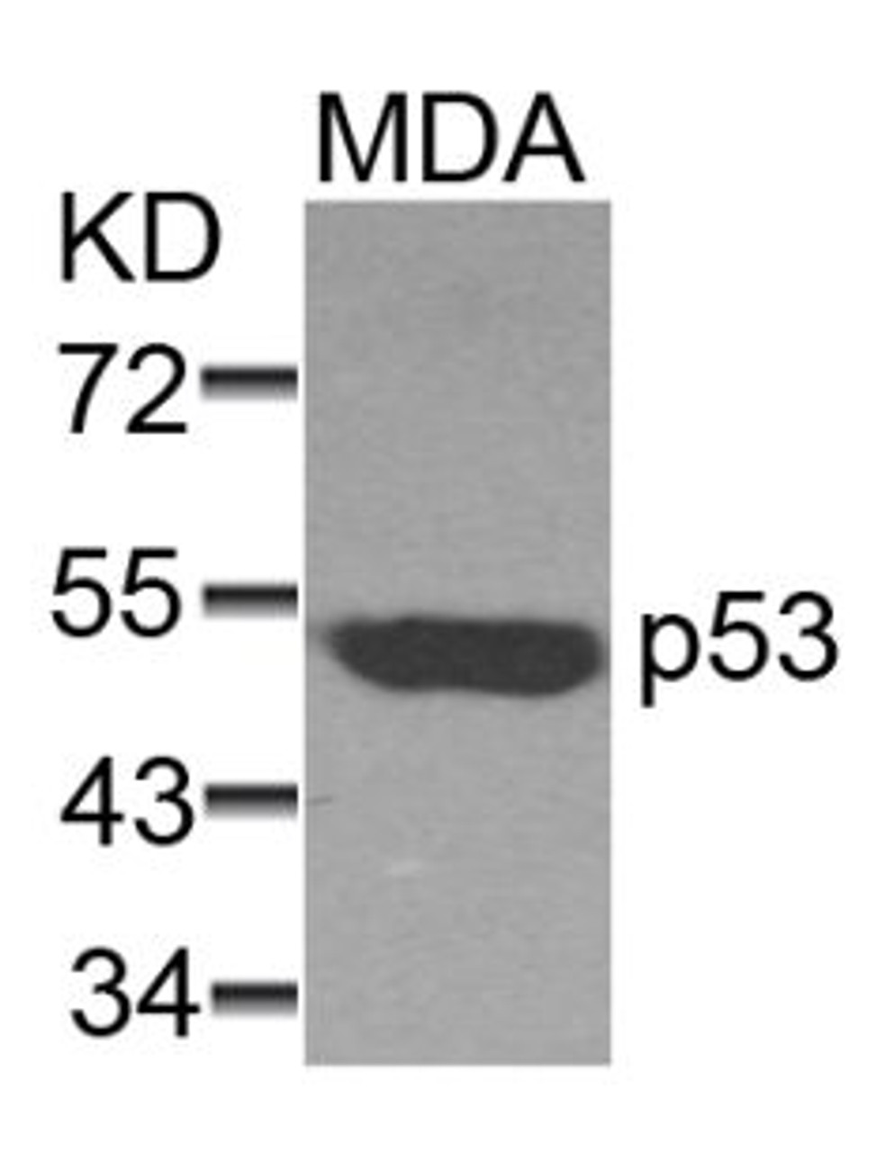 Western blot analysis of lysed extracts from MDA cells using p53 (Ab-37) .