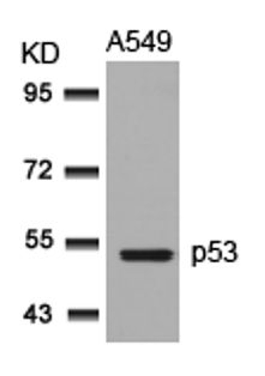 Western blot analysis of lysed extracts from A549 cells using p53 (Ab-315) .
