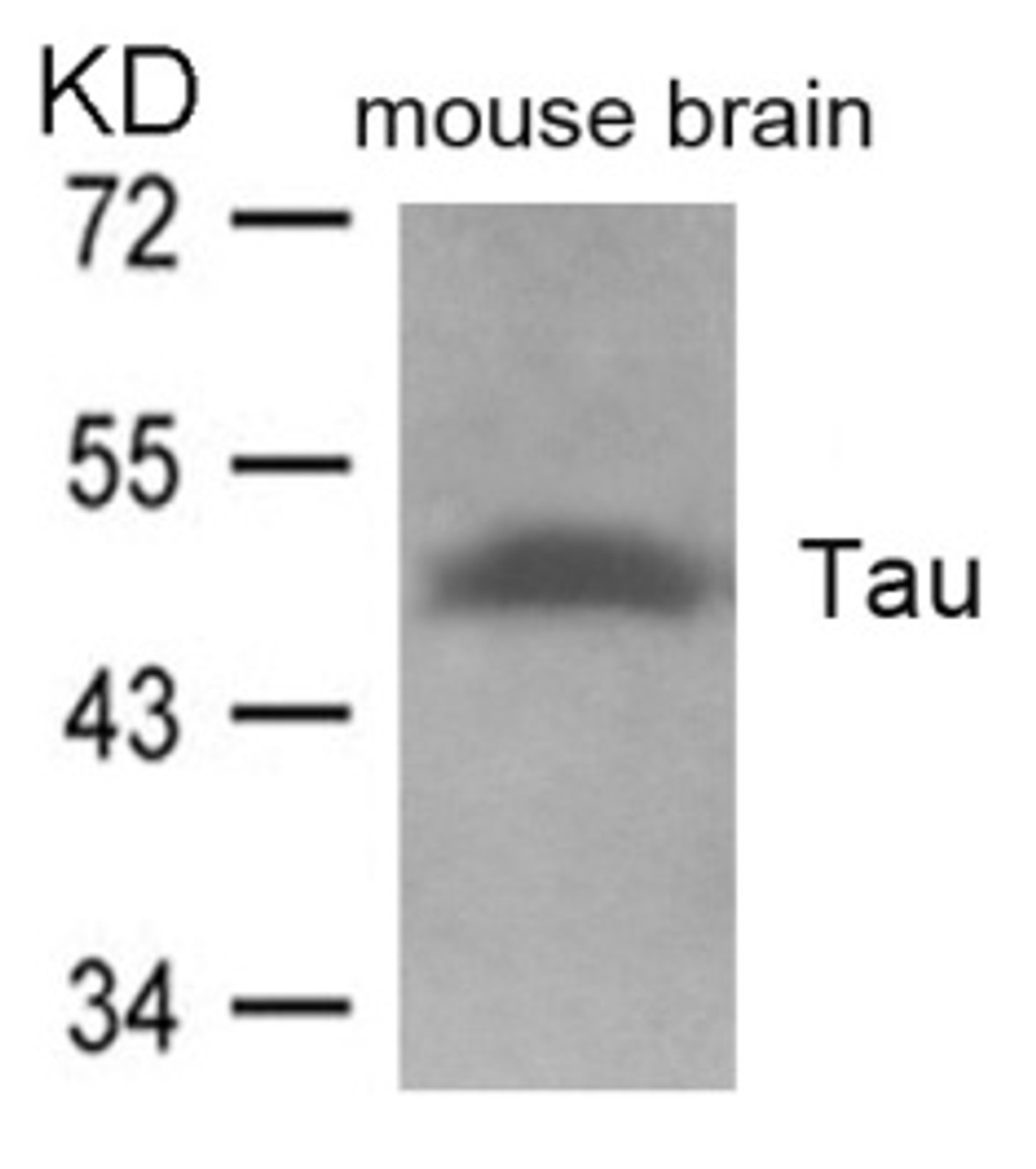 Western blot analysis of lysed extracts from mouse brain tissue using Tau (Ab-262) .