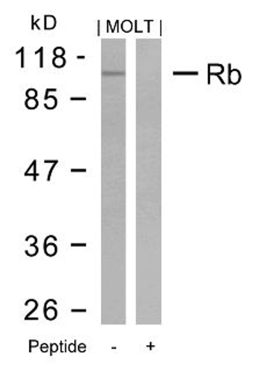Western blot analysis of lysed extracts from MOLT cells using Rb (Ab-795) .