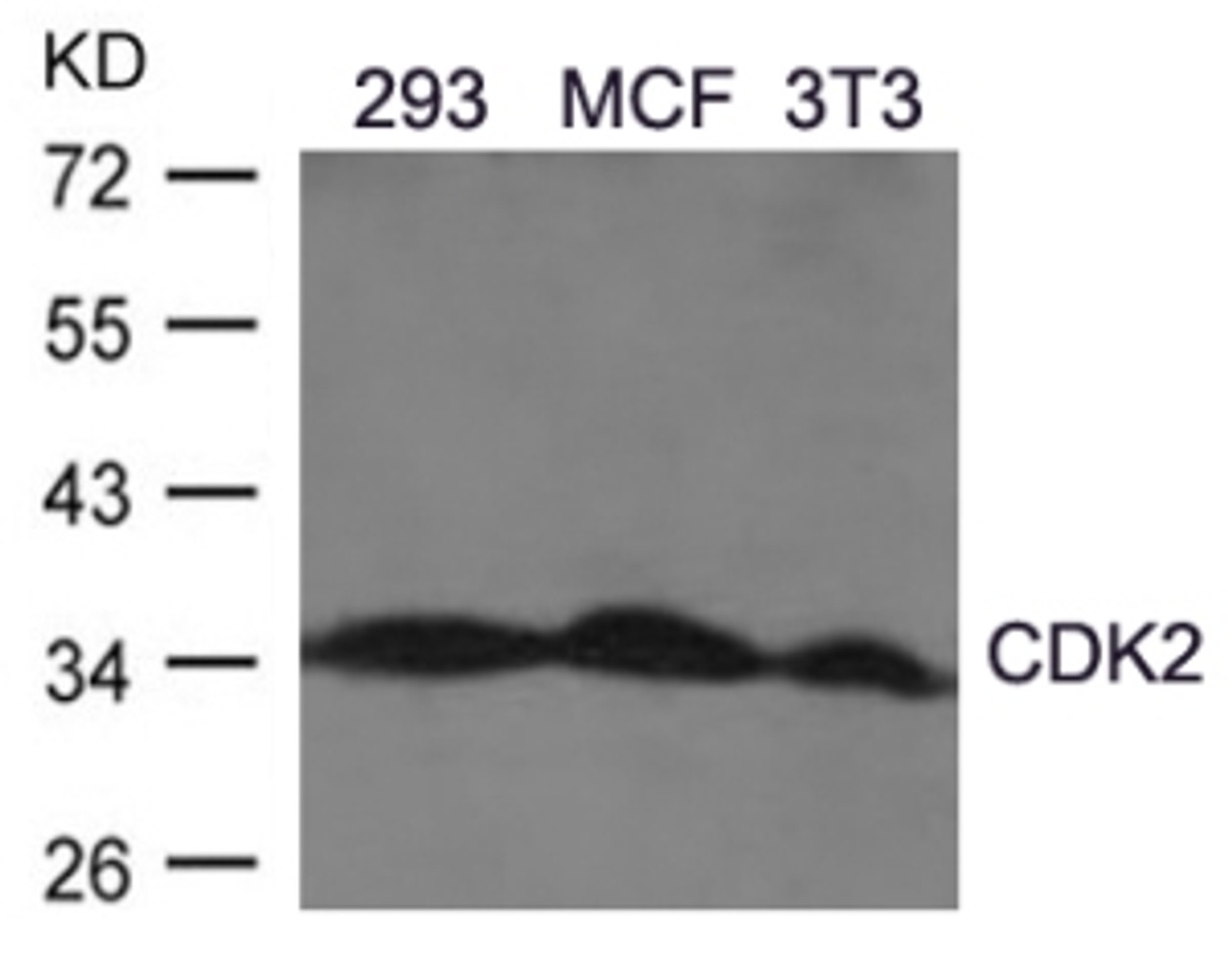 Western blot analysis of lysed extracts from A2780 cells using CDK2 (Ab-160) .