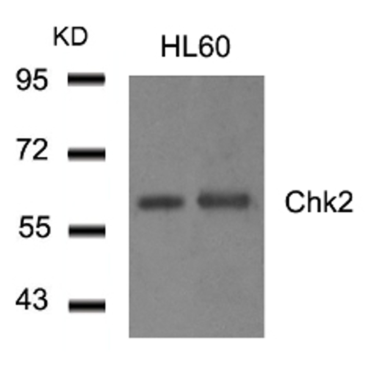 Western blot analysis of extract from HL60 cells using Chk2 (Ab-516) .