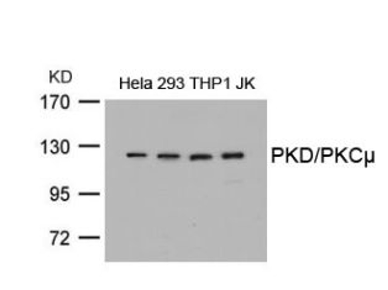 Western blot analysis of lysed extracts from HeLa, 293, THP1 and JK cells using PKD/PKC&#956; (Ab-738) .
