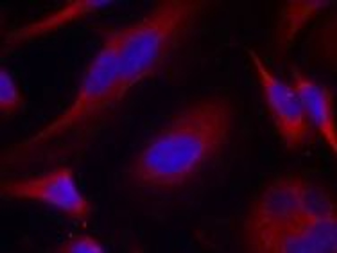 Immunofluorescence staining of methanol-fixed HeLa cells using PKD/PKC&#956; (Ab-738) .