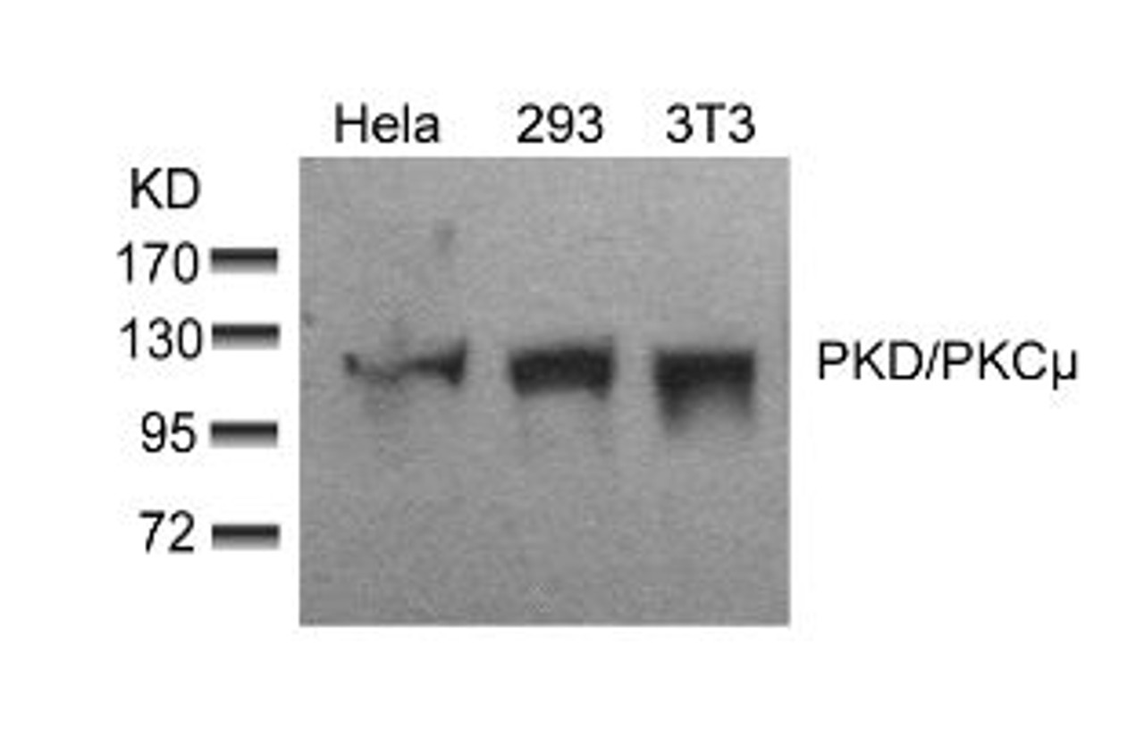 Western blot analysis of lysed extracts from HeLa, 293 and 3T3 cells using PKD/PKC&#956; (Ab-910) .
