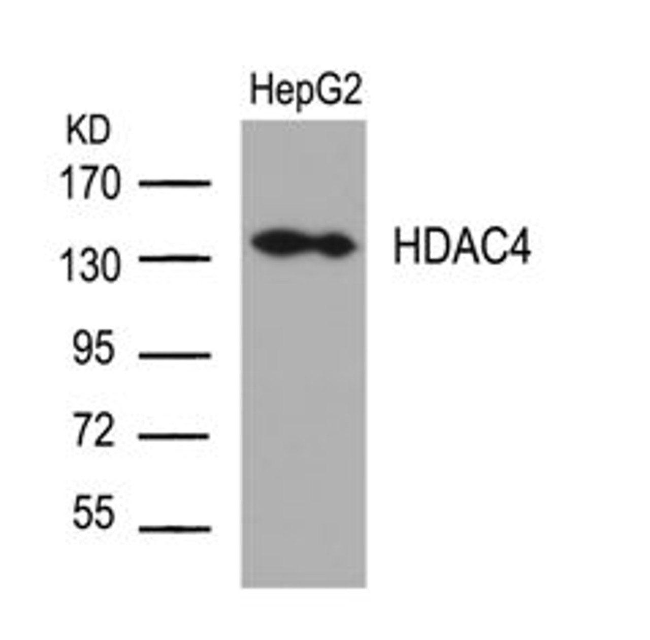Western blot analysis of lysed extracts from HepG2 cells using HDAC4 (Ab-632) .