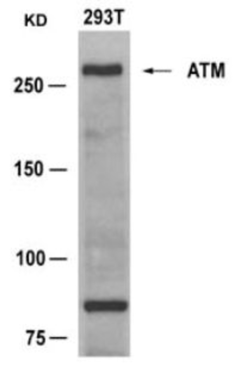 Western blot analysis of lysed extracts from 293T cells using ATM (Ab-1981) .