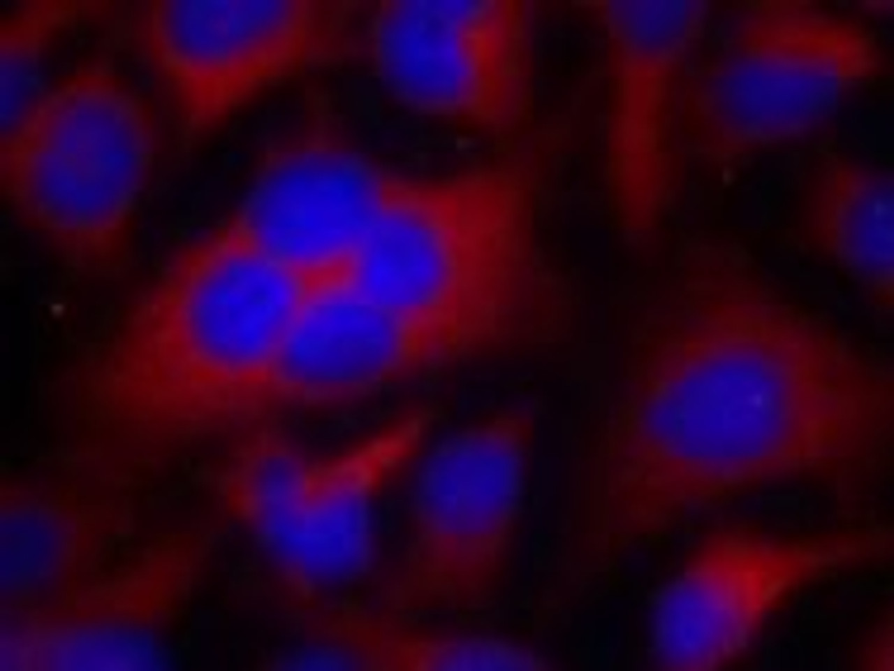 Immunofluorescence staining of methanol-fixed HeLa cells using CDC2 (Ab-161) .