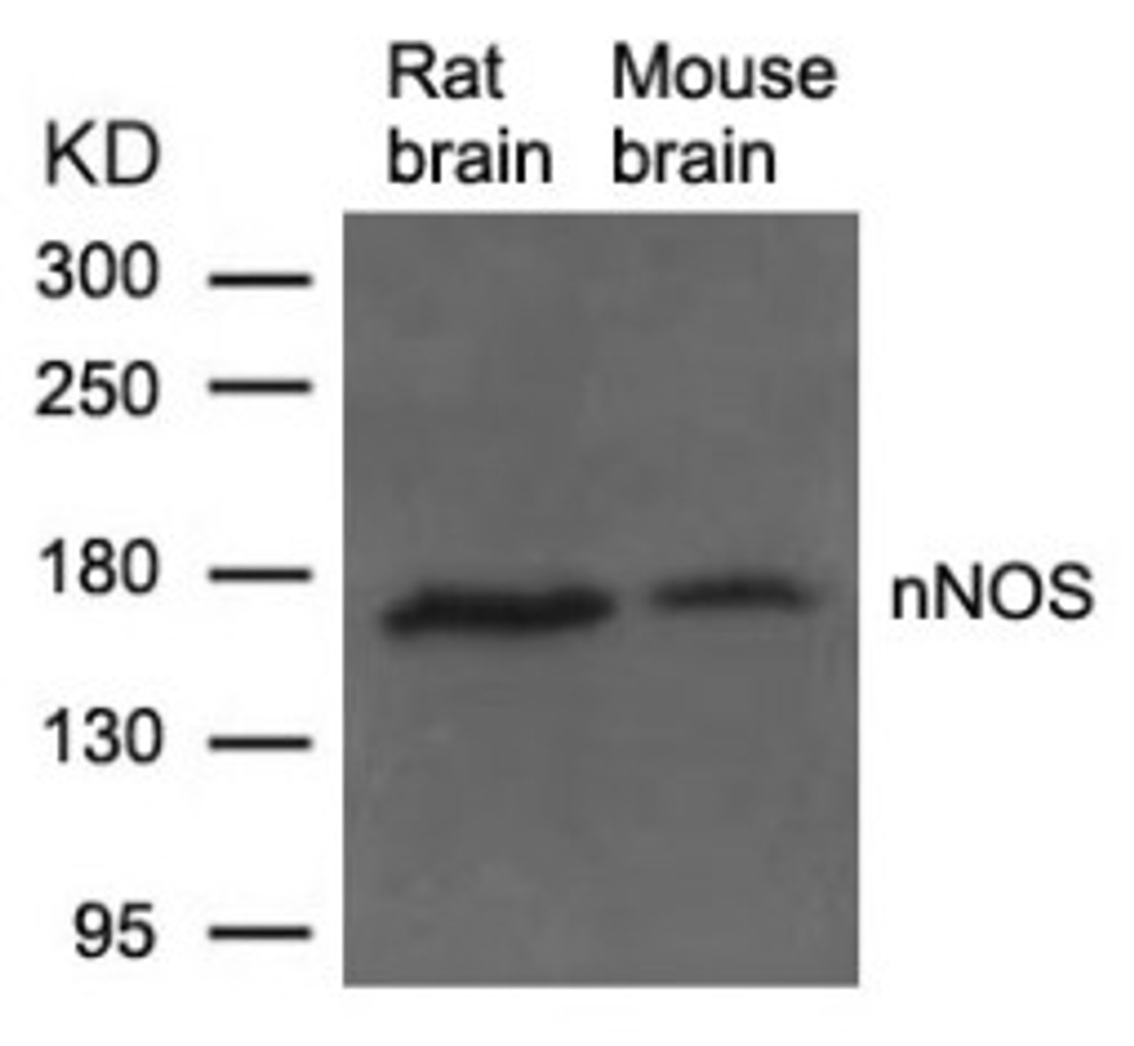 Western blot analysis of lysed extracts from Rat and Mouse brain tissue using nNOS (Ab-852) .