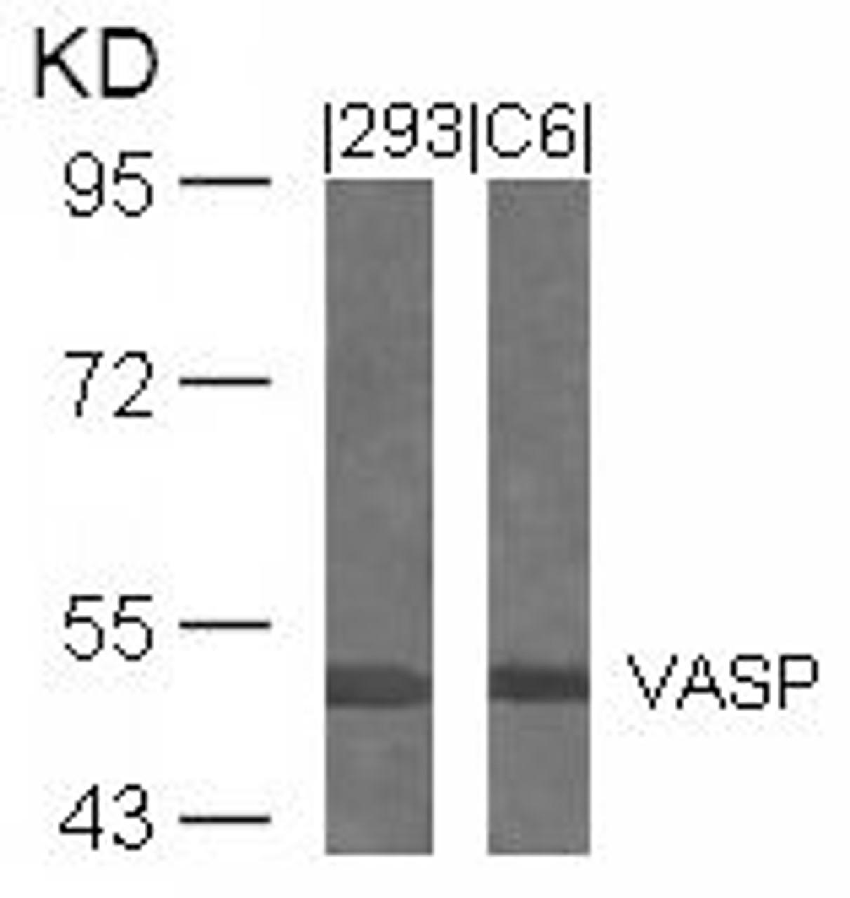 Western blot analysis of lysed extracts from 293 and C6 cells using VASP (Ab-239) .