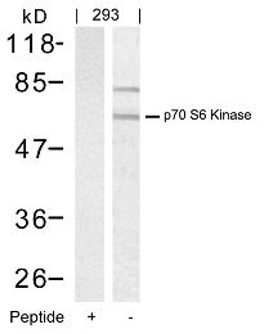 Western blot analysis of lysed extracts from 293 cells using p70 S6 Kinase (Ab-389) .