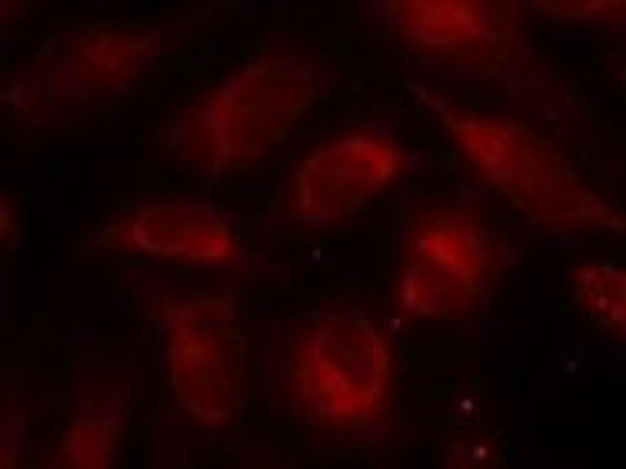 Immunofluorescence staining of methanol-fixed HeLa cells using p70 S6 Kinase (Ab-389) .