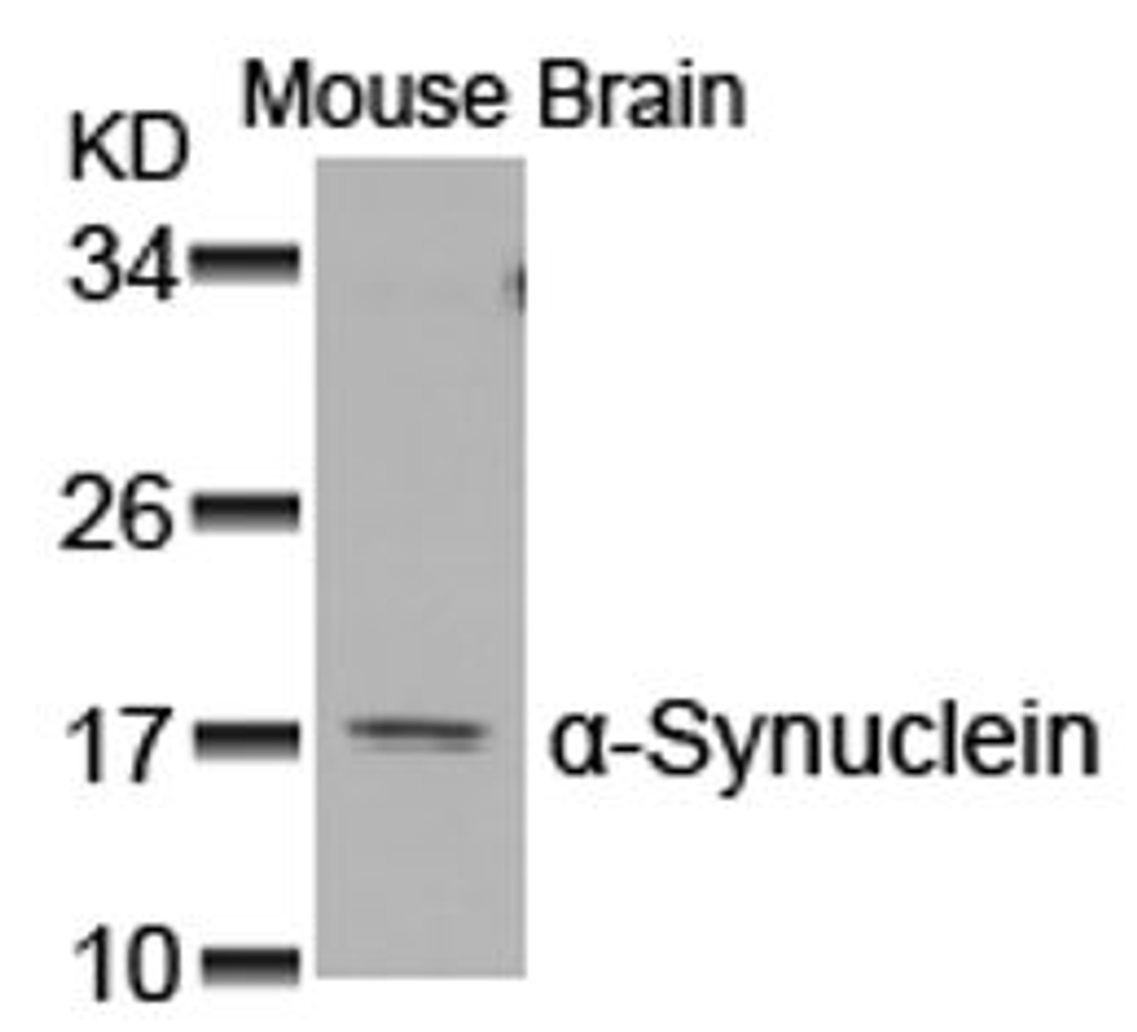 Western blot analysis of lysed extracts from Mouse Brain tissue using &#945;-Synuclein (Ab-129) .