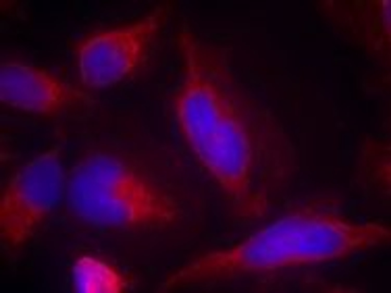 Immunofluorescence staining of methanol-fixed HeLa cells using FLT3 (Ab-591) .