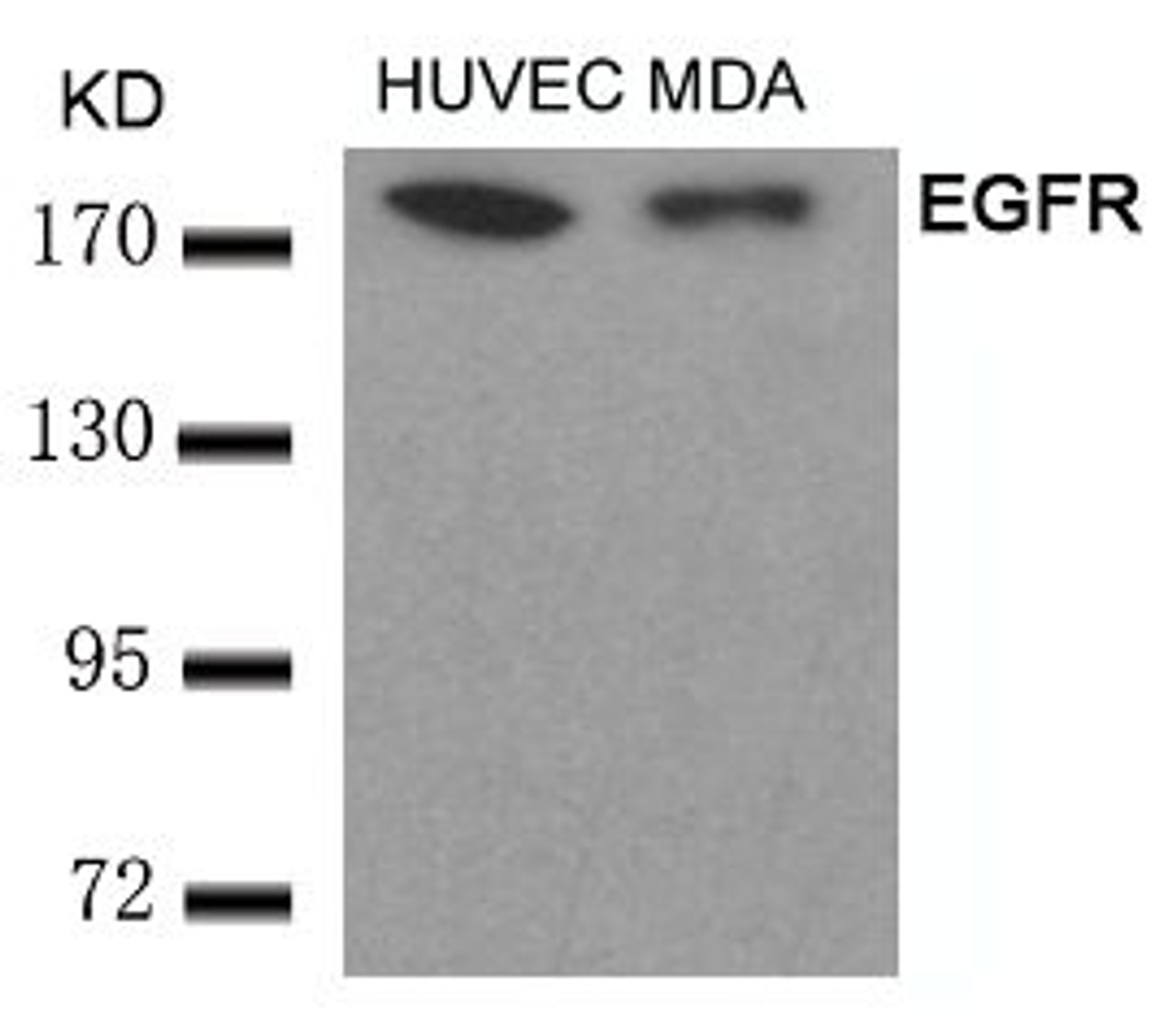 Western blot analysis of lysed extracts from HUVEC and MDA cells using EGFR (Ab-693) .
