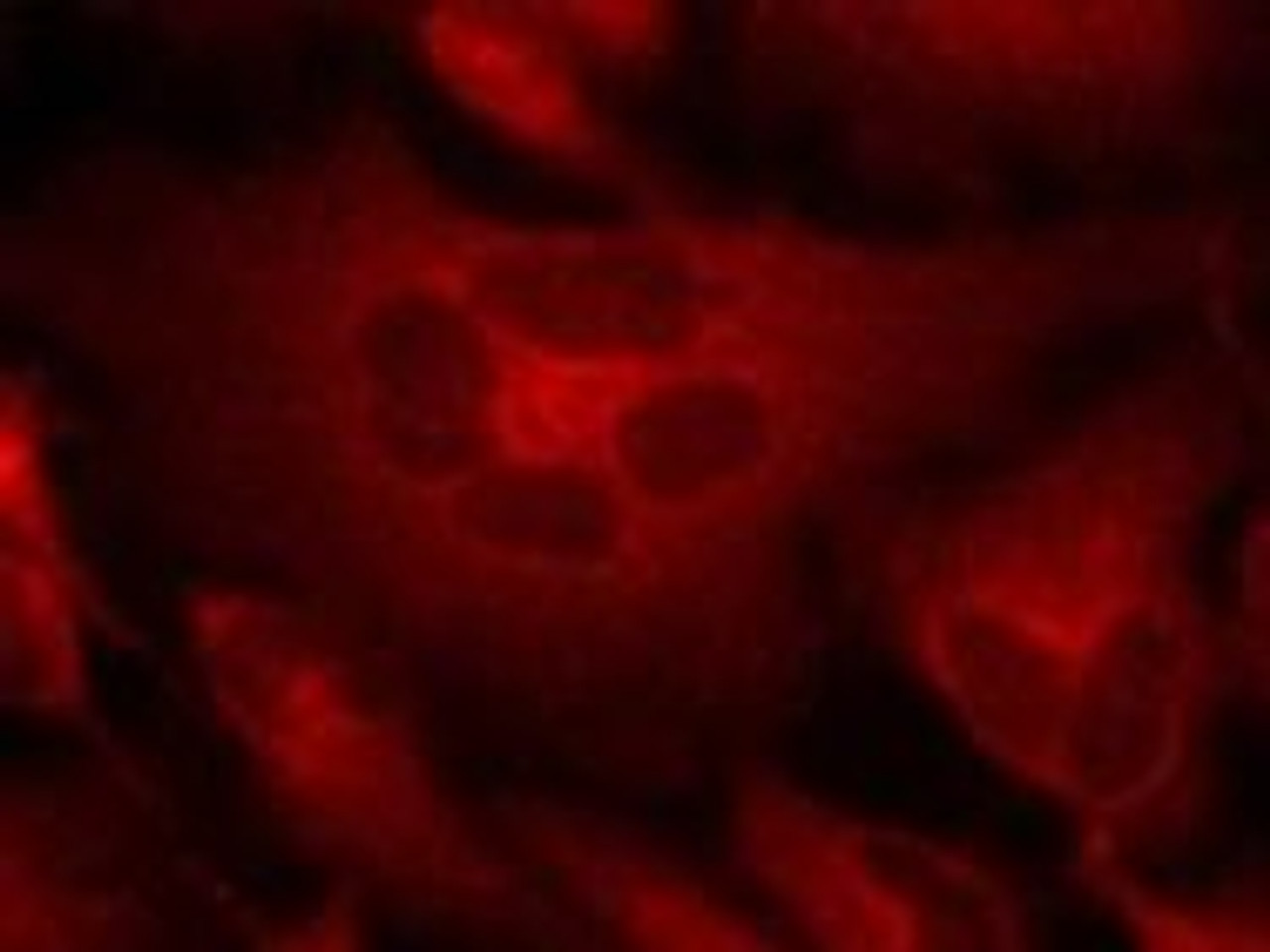Immunofluorescence staining of methanol-fixed HeLa cells using Bcr (Ab-177) .