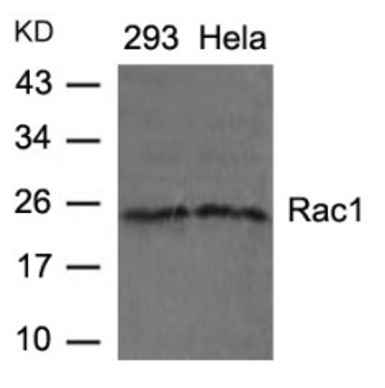 Western blot analysis of lysed extracts from 293 and HeLa cells using Rac1 (Ab-71) .